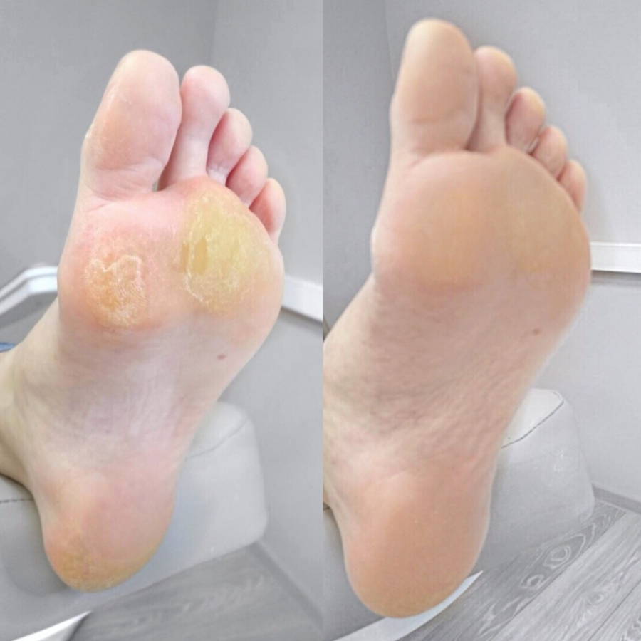 Педикюр мужской классический