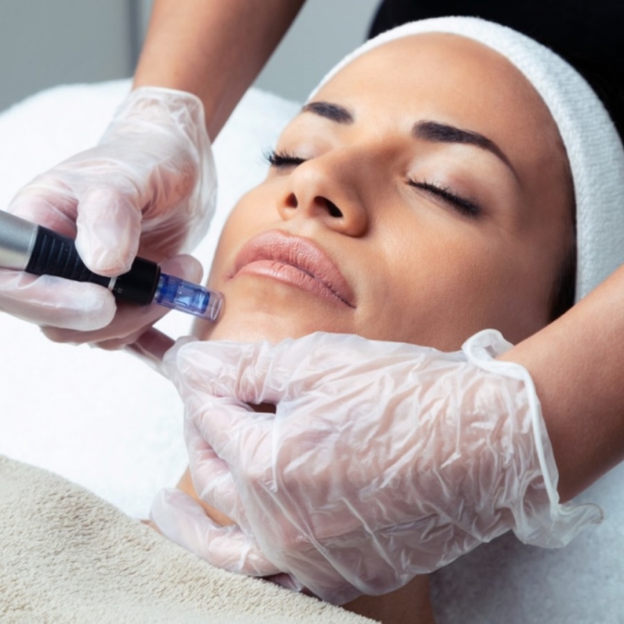 Фракционная мезотерапия