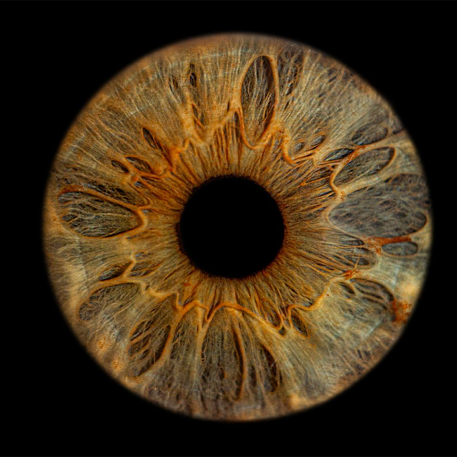 Фото одной радужки