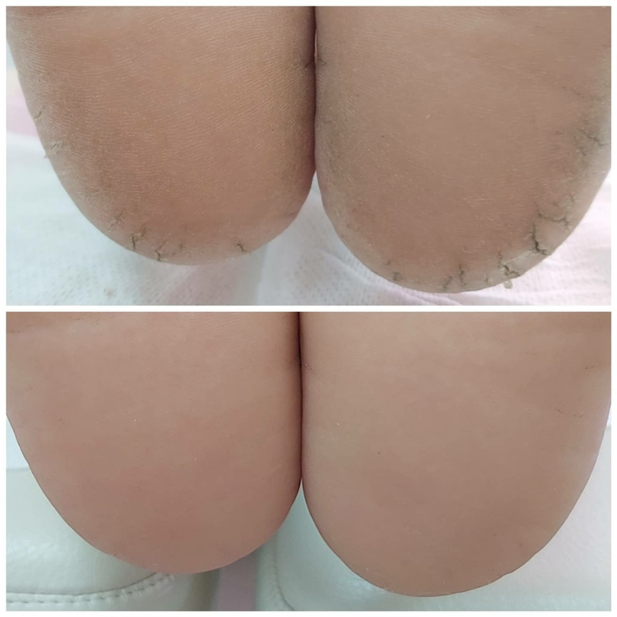 Педикюр мужской классический