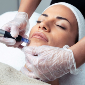 Фракционная мезотерапия