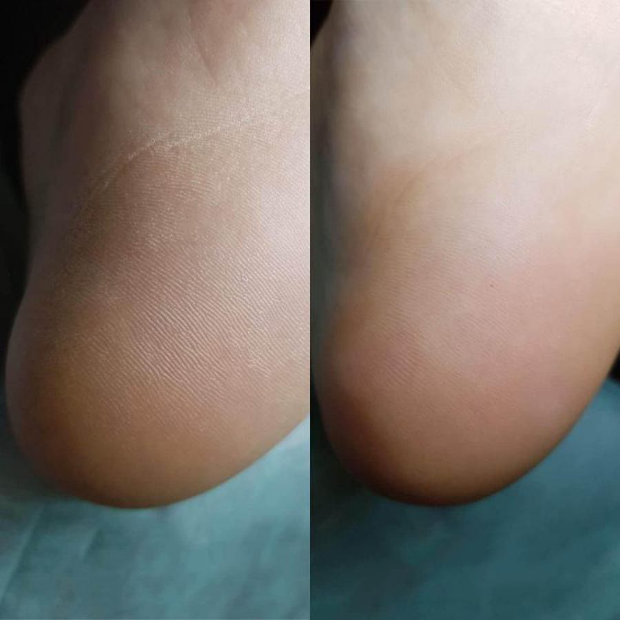 Педикюр мужской классический